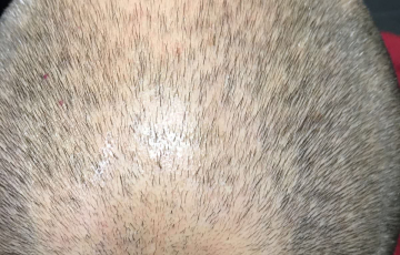 Oberkopf von Hairdreams Kunde Daniel von oben