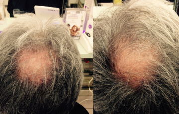 Oberkopf eines Hairdreams Kunden