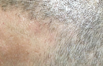 Oberkopf von Hairdreams Kunde Daniel
